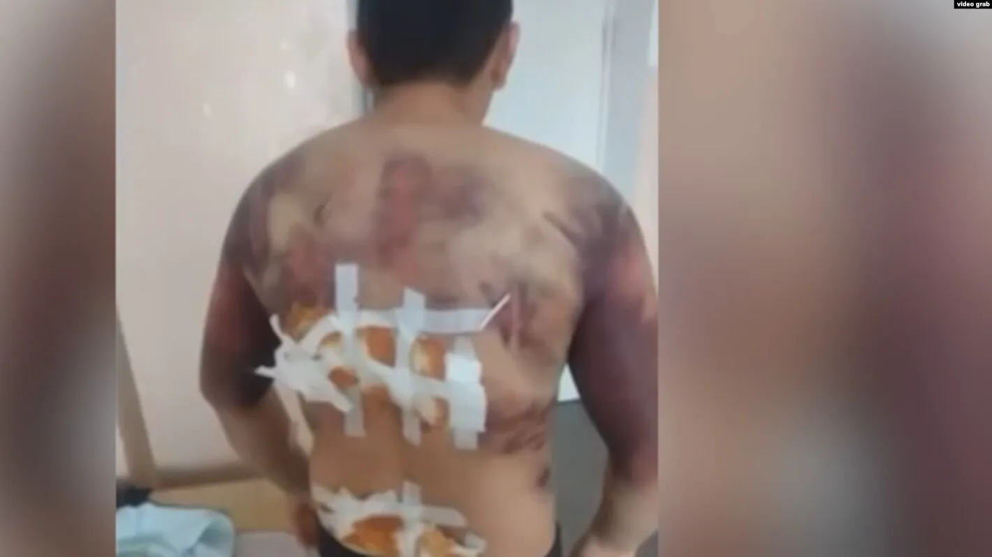 Bureau: 71 percent of those detained during the January events were tortured