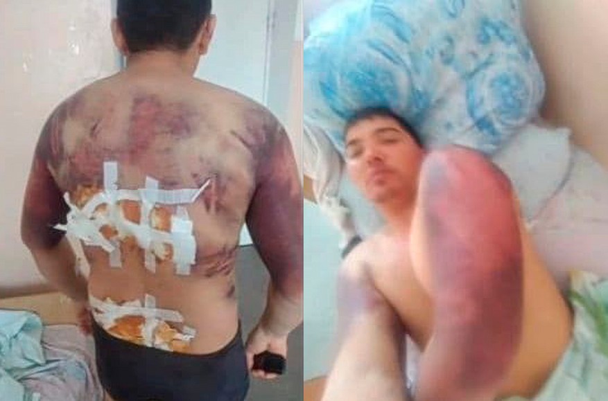 Suspect in demolition of Nazarbayev monument in Taldykorgan tells of torture. Investigation launched