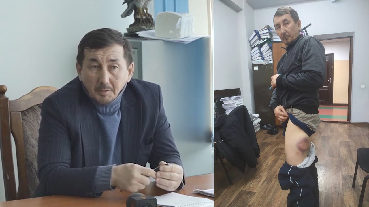 Соратник Арона Атабека избит в полиции