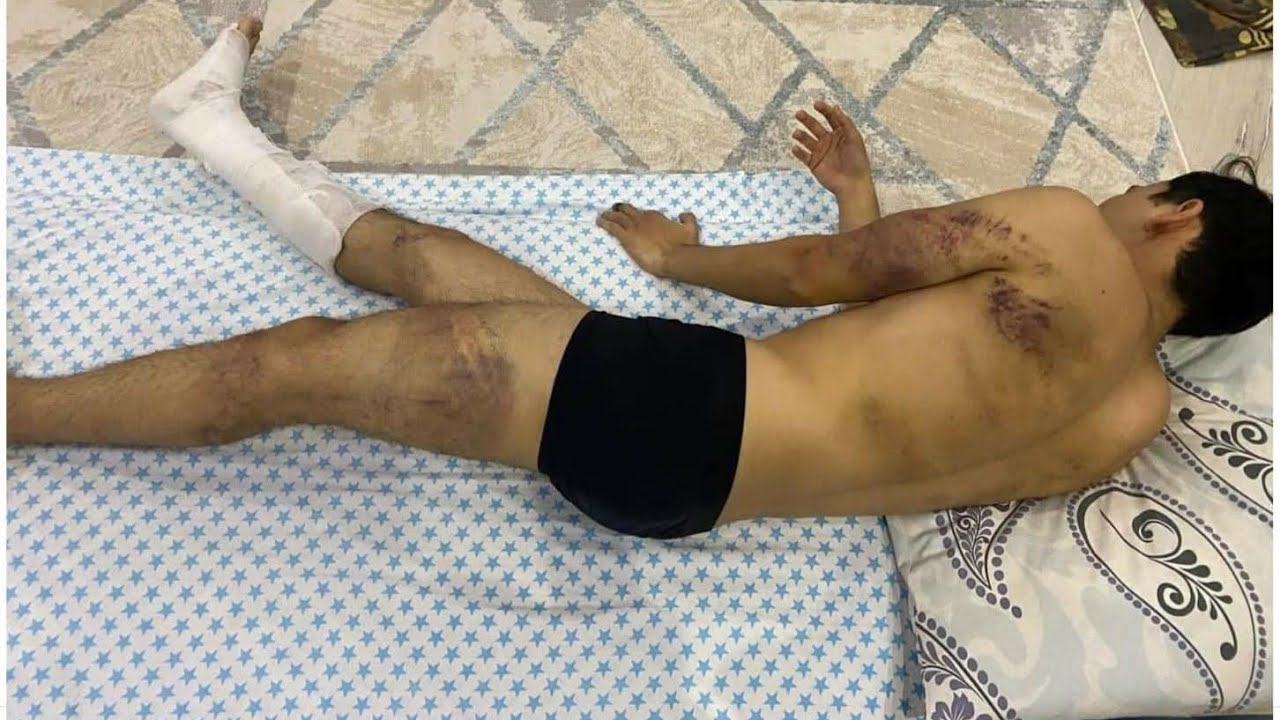 “Назарбаев қан төгіп кетті”. Жаралы адамды полиция азаптап қамады! Қазақ анасының жан айқайы!