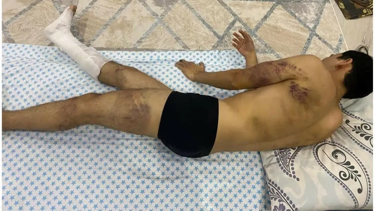 “Назарбаев қан төгіп кетті”. Жаралы адамды полиция азаптап қамады! Қазақ анасының жан айқайы!