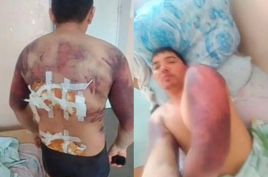 Suspect in demolition of Nazarbayev monument in Taldykorgan tells of torture. Investigation launched